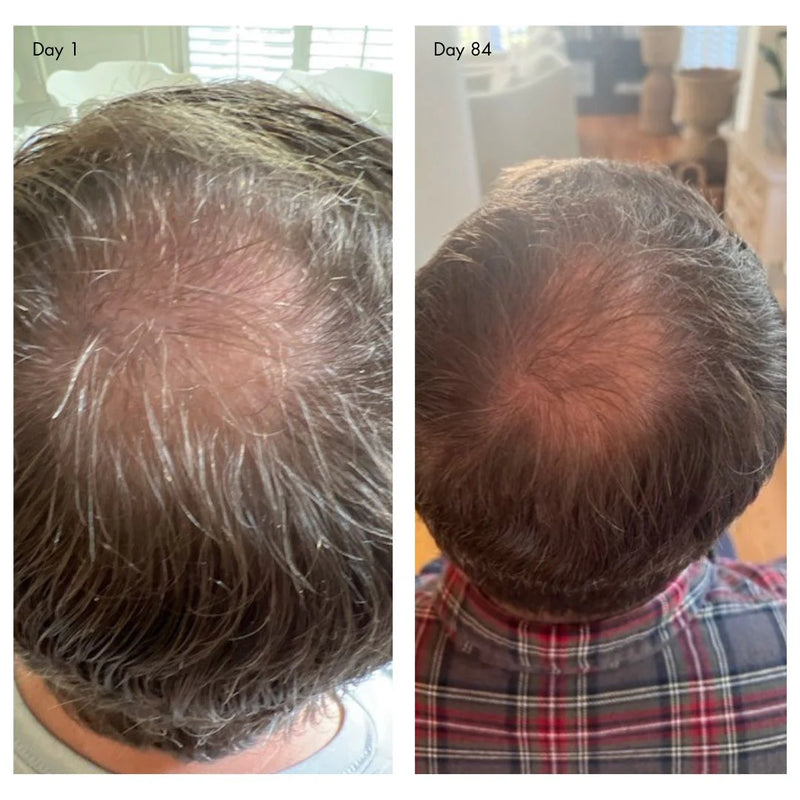 Buy Agent Nateur holi (growth) 84 advanced leave-in growth scalp treatment 120ml at One Fine Secret.