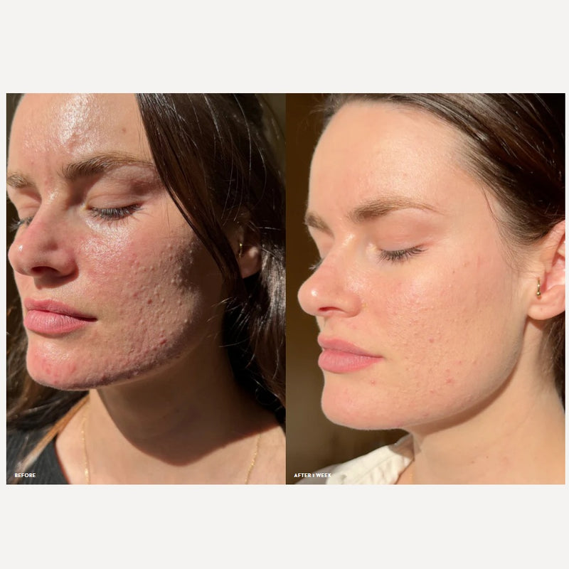 Award Winning Serum. Mukti Barrier Repair Serum Before & After Use at One Fine Secret.