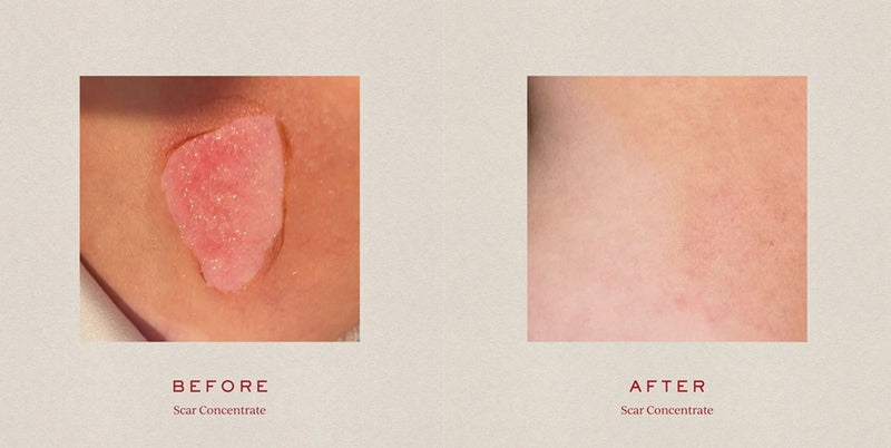 Buy Tronque Scar Concentrate 25ml at One Fine Secret Clean Beauty.