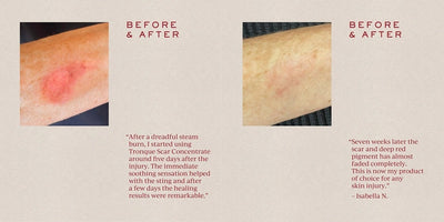 Buy Tronque Scar Concentrate 25ml at One Fine Secret Clean Beauty.