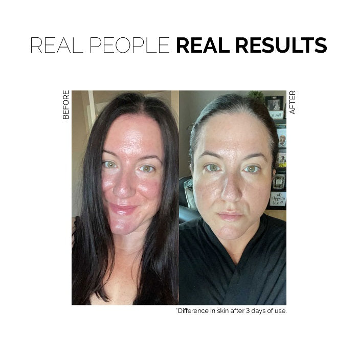 Before and after - Fitglow Beauty Redness Rescue Cream (RRC) at One Fine Secret.